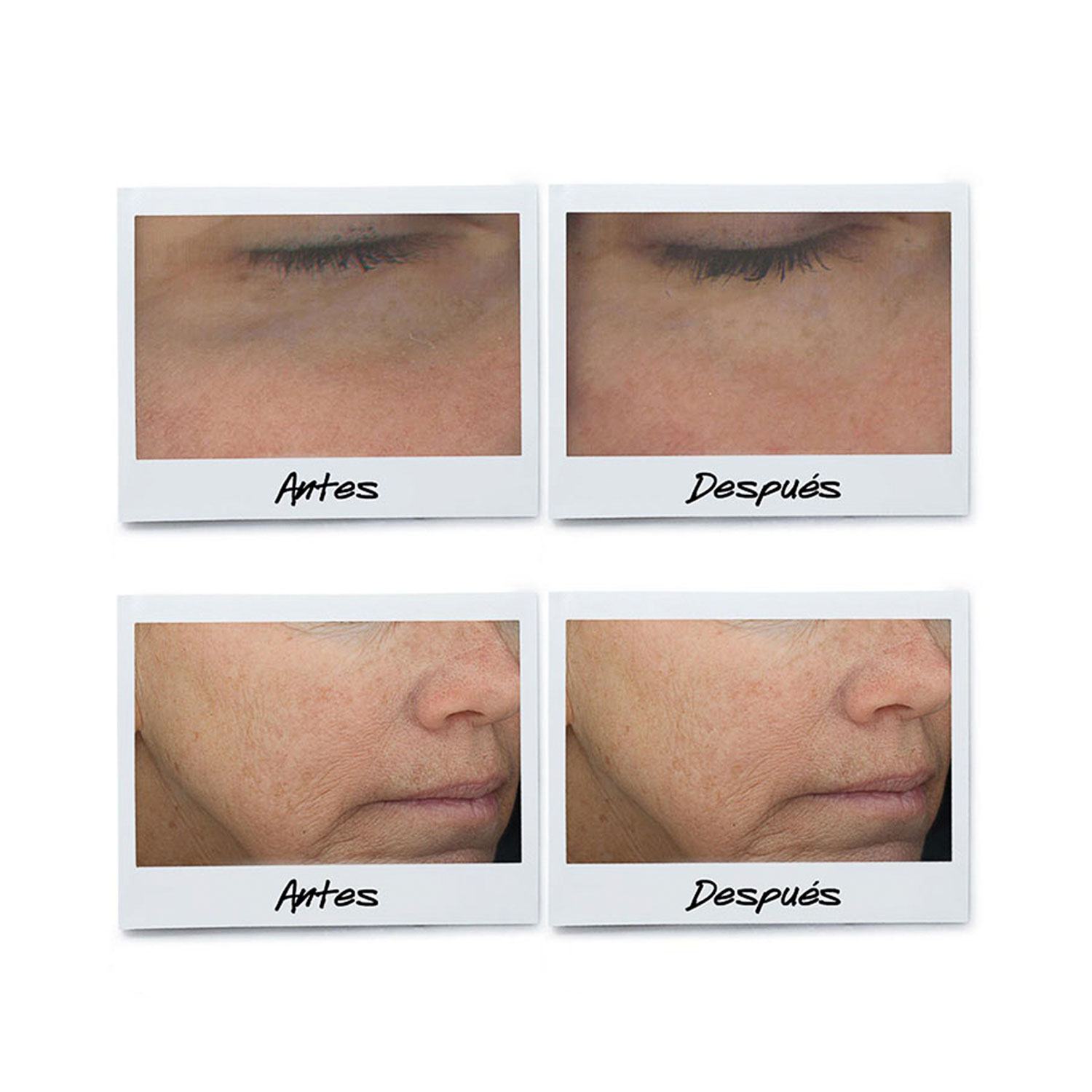POWERFUL-STRENGTH LINE-REDUCING & DARK CIRCLE-DIMINISHING VITAMIN C EYE SERUM (SUERO PARA COTORNO DE OJOS)